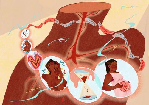 Illustration artwork representing a person with sickle cell anaemia, showing their struggles, symptoms, and feeling isolated within a healthcare system not built for their needs.