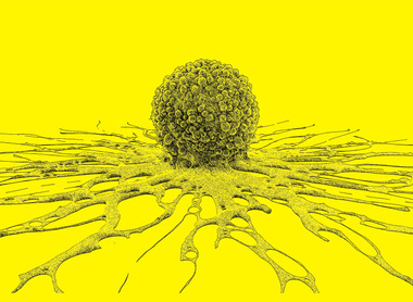 Cancer cell yellow.jpg